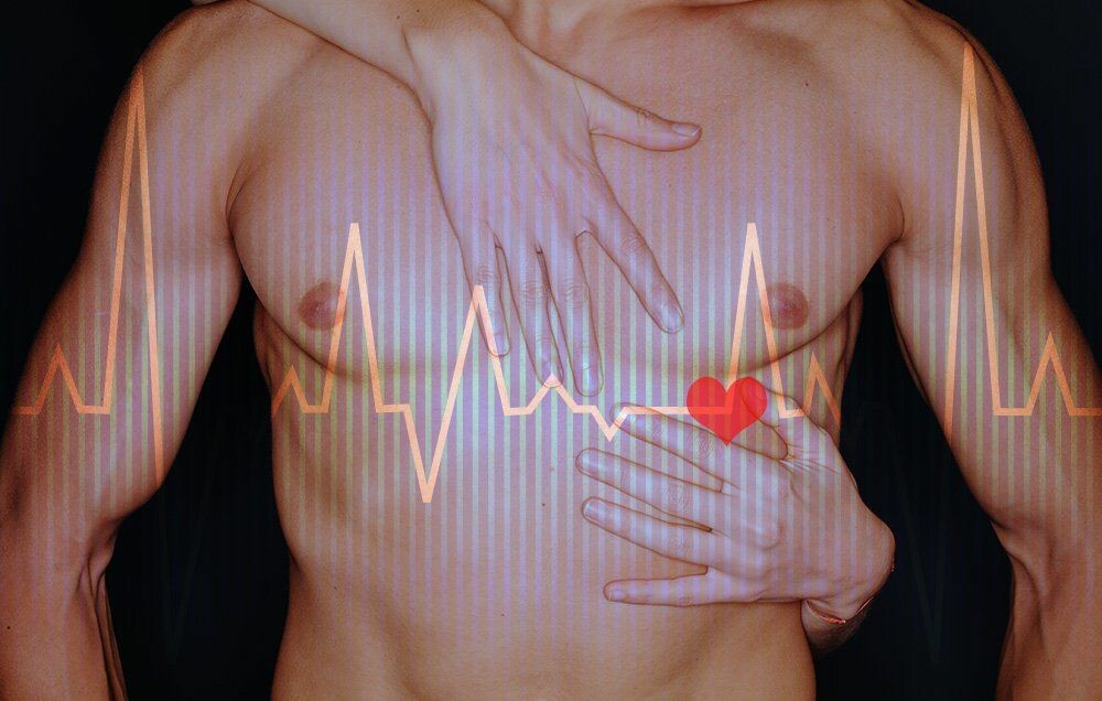 Sex and Heart Attacks